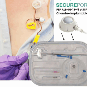 SITE OU CHAMBRE IMPLANTABLE